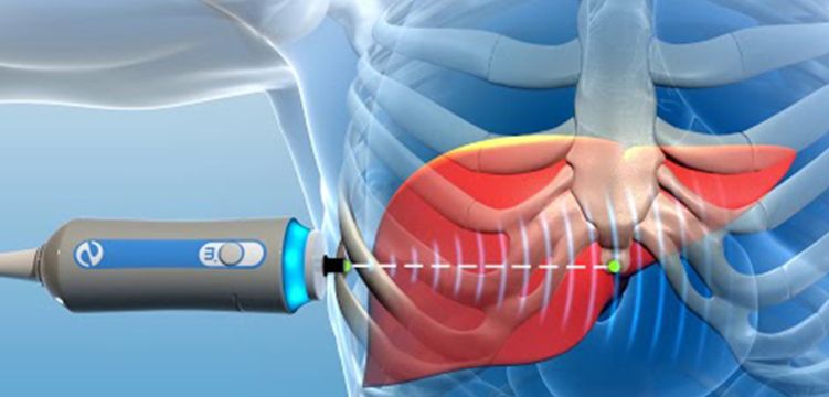 Fibroscan – Jivan Hospital